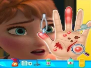 Anna frozen Hand Doctor: Fun Games for Girls Onlin Online Girls Games on NaptechGames.com