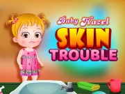 Baby Hazel Skin Trouble Online Girls Games on NaptechGames.com