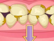 Bad Teeth Makeover Online Care Games on NaptechGames.com