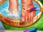 Feet Skin Doctor Online Dress-up Games on NaptechGames.com